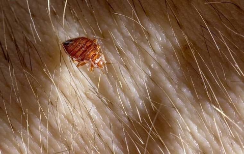 bed bug crawling through hair